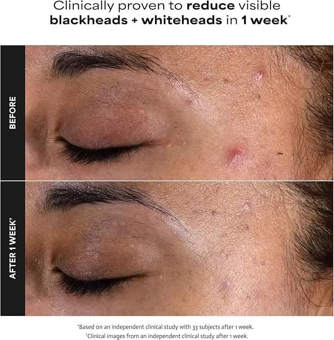 Skin Perfecting 2% BHA Liquid Exfoliant, 118 ml, Paula's Choice