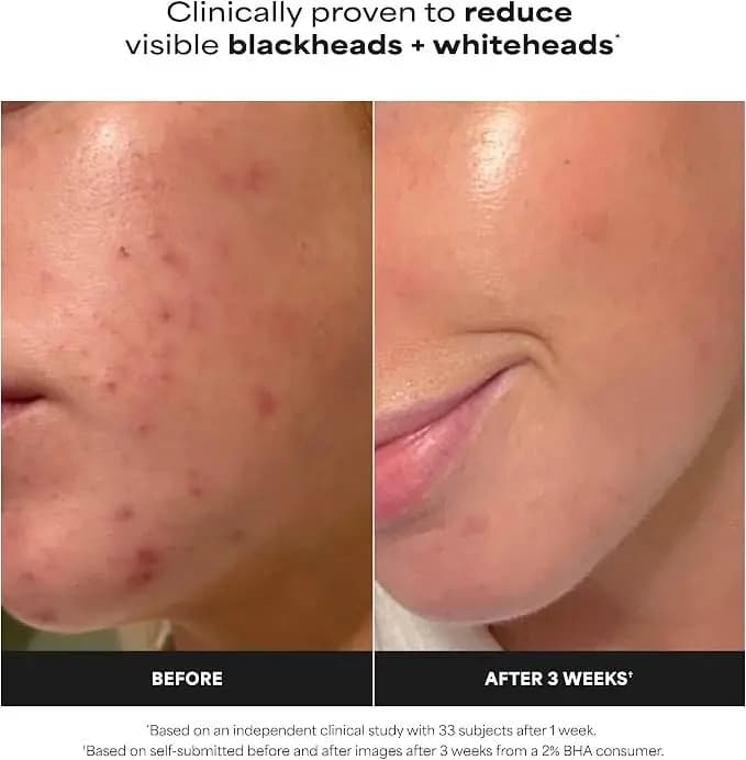 Skin Perfecting 2% BHA Liquid Exfoliant, 118 ml, Paula's Choice