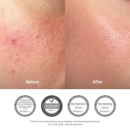 345 Relief Cream 50ml